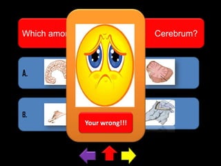 Which among this pictures is the

A.

C.

B.

D.
Your wrong!!!

Cerebrum?

 