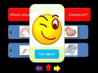 Which among this pictures is the

A.

C.

B.

D.
Your right!!!

Cerebrum?

 