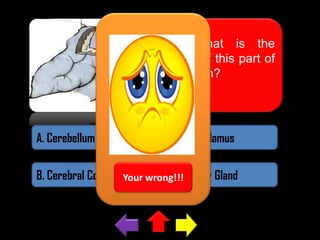what is the
name of this part of
the brain?

A. Cerebellum

C. Hypothalamus

B. Cerebral Cortex Your wrong!!!
D. Pituitary Gland

 