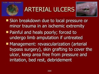 ARTERIAL ULCERS Skin breakdown due to local pressure or minor trauma in an ischemic extremity Painful and heals poorly; forced to undergo limb amputation if untreated Management: revascularization (arterial bypass surgery), skin grafting to cover the ulcer, keep area free from pressure and irritation, bed rest, debridement  2009 