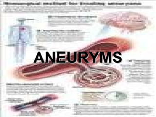 ANEURYMS 2009 