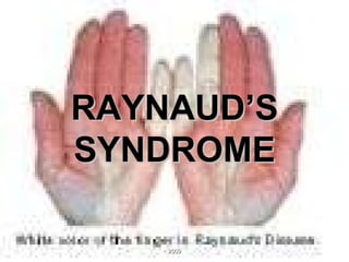 RAYNAUD’S SYNDROME 2009 