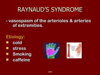 RAYNAUD’S SYNDROME - vasospasm of the arterioles & arteries of extremities. Etiology: cold stress Smoking caffeine 2009 