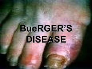 BueRGER’S DISEASE 2009 