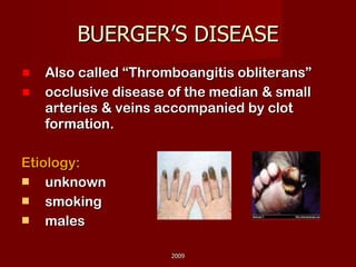 BUERGER’S DISEASE Also called “Thromboangitis obliterans” occlusive disease of the median & small arteries & veins accompanied by clot formation. Etiology: unknown  smoking males 2009 