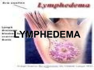 LYMPHEDEMA 2009 