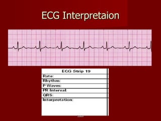 ECG Interpretaion 2009 
