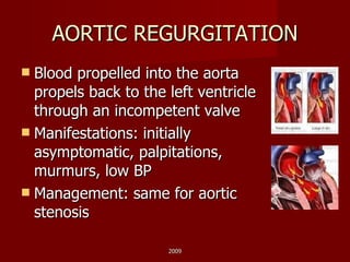 AORTIC REGURGITATION Blood propelled into the aorta propels back to the left ventricle through an incompetent valve Manifestations: initially asymptomatic, palpitations, murmurs, low BP Management: same for aortic stenosis 2009 