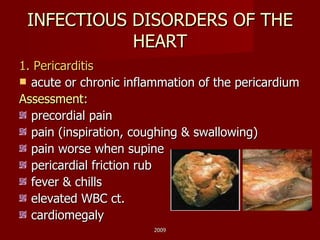INFECTIOUS DISORDERS OF THE HEART 1. Pericarditis acute or chronic inflammation of the pericardium Assessment: precordial pain  pain (inspiration, coughing & swallowing) pain worse when supine pericardial friction rub fever & chills elevated WBC ct. cardiomegaly 2009 