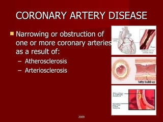 CORONARY ARTERY DISEASE Narrowing or obstruction of one or more coronary arteries as a result of: Atherosclerosis  Arteriosclerosis 2009 