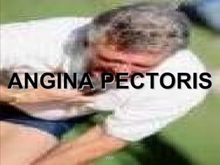 ANGINA PECTORIS 2009 
