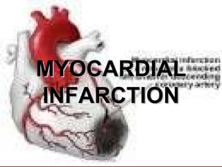 MYOCARDIAL INFARCTION 2009 