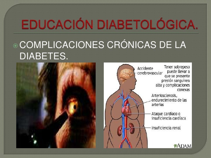 Educación en Diabetes. ciad zihuatanejo Guerrero Educación en Diabetes. ciad zihuatanejo Guerrero