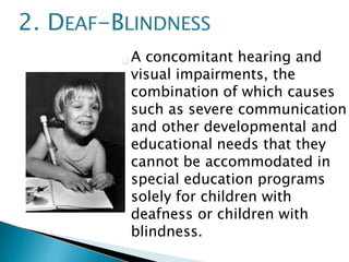 A concomitant hearing and
visual impairments, the
combination of which causes
such as severe communication
and other developmental and
educational needs that they
cannot be accommodated in
special education programs
solely for children with
deafness or children with
blindness.
2. DEAF-BLINDNESS
 
