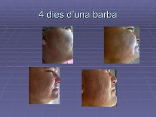 4 dies d’una barba 
