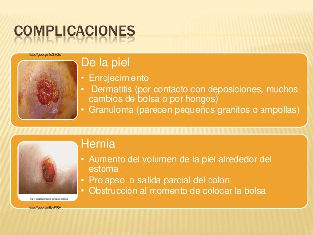 El tratamiento de la eccema en belarusi