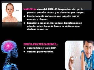 VARICELA: virus del ARN alfaherpesvirus de tipo 3.
  penetra por vías aéreas y se disemina por sangre.
• Enrojecimiento en fauces, con pápulas que se
  rompen y ulceran.
• Exantema con manchas rojizas, transforman en
  pápulas rojas, luego se forma la vesícula, que
  deviene en costra.




PROFILAXIS/TRATAMIENTO :
• vacuna triple viral o SRP.
• vacunas para varicela.
 