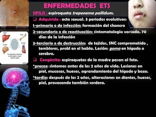 ENFERMEDADES ETS
SIFILIS : espiroqueta treponema pallidum.
 Adquirida : acto sexual. 3 periodos evolutivos:
1-primario o de infección: formación del chancro
2-secundario o de reactivación: sintomatología variada. 70
   días de la infección
3-terciario o de destrucción: de tejidos, SNC comprometido ,
   temblores, probl en el habla. Lesión: goma en hígado o
   cerebro.
 Congénita: espiroquetas de la madre pasan al feto.
*precoz: síntomas antes de los 2 años de vida. Lesiones en
   piel, mucosas, huesos, agrandamiento del hígado y bazo.
*tardía: después de los 2 años, alteraciones en dientes, huesos,
   piel, provocando también sordera.
 