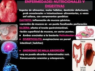 ENFERMEDADES NUTRICIONALES Y
            DIGESTIVAS
Ingesta de alimentos, malos hábitos, dentición defectuosa,
    prob emocionales o intoxicaciones alimentarias, a veces
    enf celiaca, con componentes genéticos
GASTRITIS: inflamación de mucosa gástrica.
-corrosión de mucosa en un punto focalizado: perforación
ULCERA: afecta el tracto gastrointestinal.
-lesión superficial de mucosa, en varios puntos.
• Ambas asociadas a la bacteria Helicobacter pylori
• DIVERTICULITIS: evaginaciones en pared
 intestinal ( bolsitas)

• SINDROMES DE MALA ABSORCIÓN
-org no puede absorber determinadas sust.
 Consecuencias anemias y osteoporosis.
 