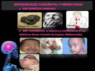 ENFERMEDADES CONGÉNITAS Y HEREDITARIAS
  • ENF GENETICAS HUMANAS:




                      Alzheimer        Hemofilia
  Melanoma maligno
  • ENF CONGÉNITAS: se adquiere y manifiesta en el nac.
  defecto en forma o función de órganos. Malformación.




   Anencefalia
 
