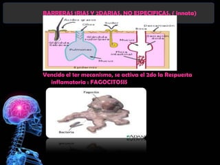 BARRERAS 1RIAS Y 2DARIAS, NO ESPECIFICAS. ( innata)




Vencido el 1er mecanismo, se activa el 2do la Respuesta
  inflamatoria : FAGOCITOSIS
 