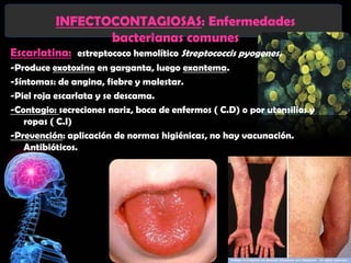 INFECTOCONTAGIOSAS: Enfermedades
                 bacterianas comunes
Escarlatina: estreptococo hemolítico Streptococcis pyogenes.
-Produce exotoxina en garganta, luego exantema.
-Síntomas: de angina, fiebre y malestar.
-Piel roja escarlata y se descama.
-Contagio: secreciones nariz, boca de enfermos ( C.D) o por utensilios y
   ropas ( C.I)
-Prevención: aplicación de normas higiénicas, no hay vacunación.
   Antibióticos.
 