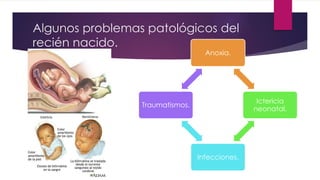 Algunos problemas patológicos del
recién nacido.
Anoxia.
Ictericia
neonatal.
Infecciones.
Traumatismos.
 