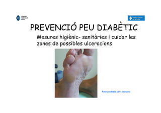 PREVENCIÓ PEU DIABÈTIC
Mesures higiènic- sanitàries i cuidar les
zones de possibles ulceracions
Fotos cedides per I. Soriano
 