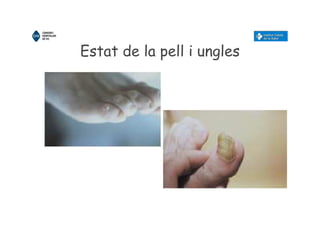Estat de la pell i ungles
 