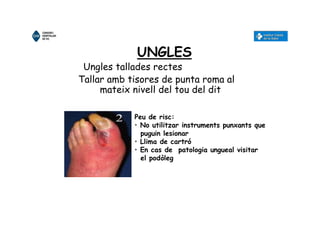 UNGLES
Ungles tallades rectes
Tallar amb tisores de punta roma al
mateix nivell del tou del dit
Peu de risc:
• No utilitzar instruments punxants que
puguin lesionar
• Llima de cartró
• En cas de patologia ungueal visitar
el podòleg
 
