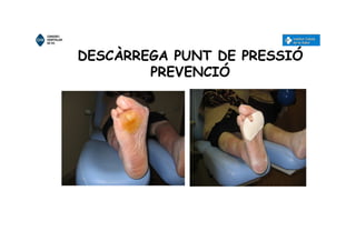 DESCÀRREGA PUNT DE PRESSIÓ
PREVENCIÓ
 