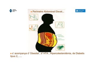 ssssssss’’’’’’’’ acompanya dacompanya dacompanya dacompanya dacompanya dacompanya dacompanya dacompanya d’’’’’’’’ Obesitat , dObesitat , dObesitat , dObesitat , dObesitat , dObesitat , dObesitat , dObesitat , d’’’’’’’’ HTA , HipercolesterolHTA , HipercolesterolHTA , HipercolesterolHTA , HipercolesterolHTA , HipercolesterolHTA , HipercolesterolHTA , HipercolesterolHTA , Hipercolesterolèèèèèèèèmia, de Diabetismia, de Diabetismia, de Diabetismia, de Diabetismia, de Diabetismia, de Diabetismia, de Diabetismia, de Diabetis
tipus 2,tipus 2,tipus 2,tipus 2,tipus 2,tipus 2,tipus 2,tipus 2,……………………................
PerPerPerPerPerPerPerPeríííííííímetre Abdominal Elevat...metre Abdominal Elevat...metre Abdominal Elevat...metre Abdominal Elevat...metre Abdominal Elevat...metre Abdominal Elevat...metre Abdominal Elevat...metre Abdominal Elevat...
 