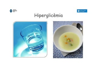 Hiperglicèmia
 