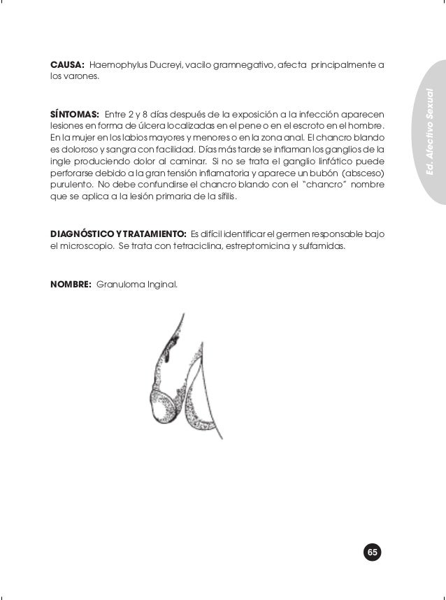 Aumentar el miembro el ejercicio