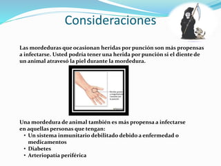 Consideraciones
Las mordeduras que ocasionan heridas por punción son más propensas
a infectarse. Usted podría tener una herida por punción si el diente de
un animal atravesó la piel durante la mordedura.
Una mordedura de animal también es más propensa a infectarse
en aquellas personas que tengan:
• Un sistema inmunitario debilitado debido a enfermedad o
medicamentos
• Diabetes
• Arteriopatía periférica
 