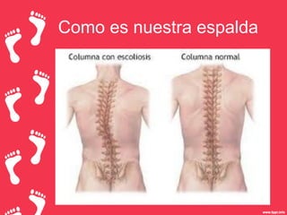 Como es nuestra espalda

 