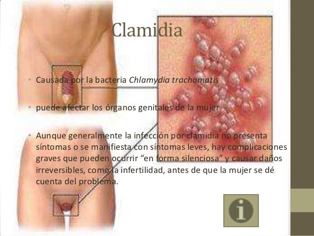 El alquitrán líquido para el tratamiento de la psoriasis