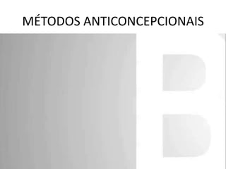 MÉTODOS ANTICONCEPCIONAIS

 