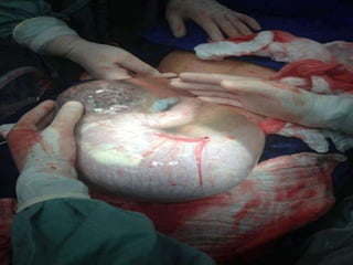 Educação em saude na adolescencia