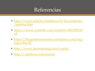 Referencias
 http://www.ufrrj.br/institutos/it/de/acidentes
/queima.htm
 https://www.youtube.com/watch?v=Mrl7J9vS3
x4
 https://blogenfermeirando.wordpress.com/tag/
regra-dos-9/
 http://www.dermatologia.net/a-pele/
 http://cabuloso.com/portal/
 