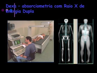 Dexa – absorciometria com Raio X de
energia Dupla
 