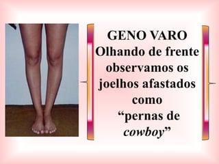 GENO VARO
Olhando de frente
 observamos os
joelhos afastados
      como
    “pernas de
     cowboy”
 
