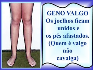 GENO VALGO
Os joelhos ficam
    unidos e
os pés afastados.
 (Quem é valgo
       não
    cavalga)
 