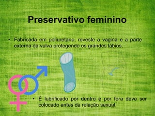 Preservativo feminino
• Fabricada em poliuretano, reveste a vagina e a parte
externa da vulva protegendo os grandes lábios.
• É lubrificado por dentro e por fora deve ser
colocado antes da relação sexual.
 