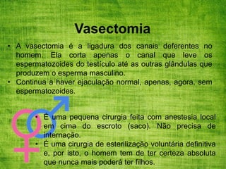 Vasectomia
• A vasectomia é a ligadura dos canais deferentes no
homem. Ela corta apenas o canal que leve os
espermatozoides do testículo até as outras glândulas que
produzem o esperma masculino.
• Continua a haver ejaculação normal, apenas, agora, sem
espermatozoides.
• É uma pequena cirurgia feita com anestesia local
em cima do escroto (saco). Não precisa de
internação.
• É uma cirurgia de esterilização voluntária definitiva
e, por isto, o homem tem de ter certeza absoluta
que nunca mais poderá ter filhos.
 