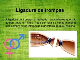 Ligadura de trompas
• A ligadura de trompas é realizada nas mulheres que não
querem mais ter filhos. Pode ser feita de várias maneiras
mas sempre exige internação e anestesia geral ou regional.
 