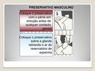 Só um espermatozóide é que entra