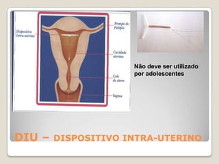 Gâmeta masculino?Gâmeta feminino