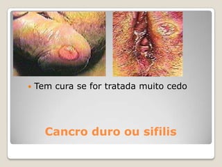 Alterações psicológicas e sociaisAs alterações corporais são vivenciadas de forma diferente, de jovem para jovem. Podem aparecer sentimentos de vergonha, timidez, pudor e até ansiedade, nomeadamente em casa, junto dos pais e dos irmãos, e na escola, junto dos colegas e das colegas.Por outro lado as hormonas que são responsáveis por estas modificações, produzem um acentuado aumento do desejo sexual e das sensações eróticas. É a partir desta fase que se vai desenvolver a resposta sexual adulta.As relações entre os dois sexos também vão sofrer alterações importantes. É frequente professores e pais relatarem situações de afastamento e mesmo hostilidade entre rapazes e raparigas na escola, em casa ou em grupos de amigos.