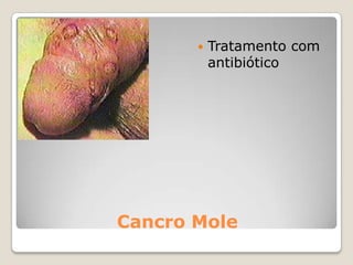 Alterações psicológicas e sociaisOutra manifestação é a constituição de grupos e de espaços ferozmente mono-sexuais(proibição absoluta dos rapazes entrarem nos grupos das raparigas e vice-versa). É como se houvesse um período em que se torna interiormente muito importante mostrar claramente, a si mesmo e aos outros, que se pertence a um sexo bem definido, com características muito específicas e opostas ao outro sexo.  Outro comportamento importante em alguns dos rapazes e raparigas pré-adolescentes é a masturbação que funciona como uma descoberta do corpo e de novas sensações. Pode ser vivida com um misto de prazer e de curiosidade, mas também com muitas dúvidas ou culpabilidades, dados os comentários negativos ou o silêncio dos adultos sobre este assunto.